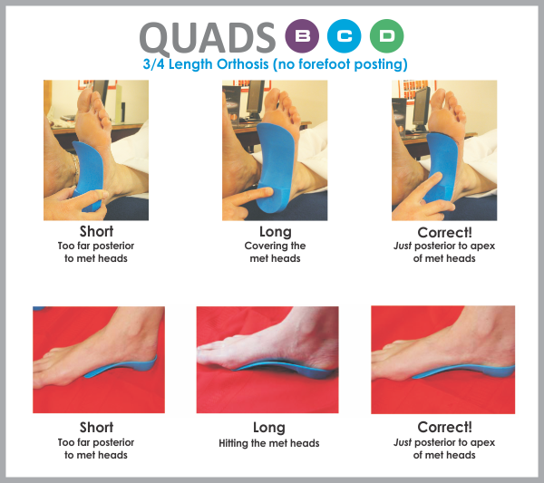 How to fit 3/4 length QUADRASTEP® orthotics from Nolaro24, LLC